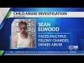 Richmond man faces child abuse charges after allegedly breaking child's collarbone