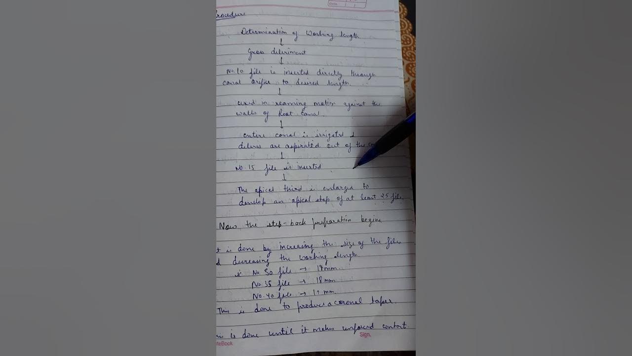 Step back technique endodontics YouTube