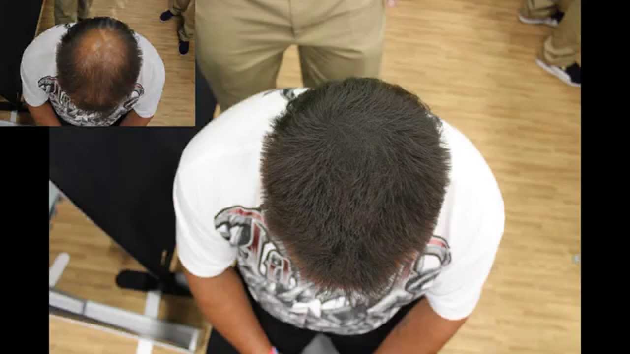 Eclipse Instant Hair Filler | World's Fair Show in Austin, Texas 2014