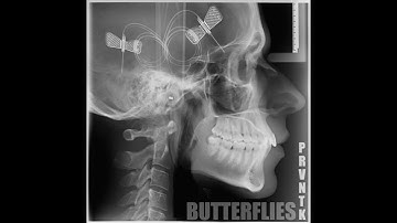 PRVNTK - BUTTERFLIES