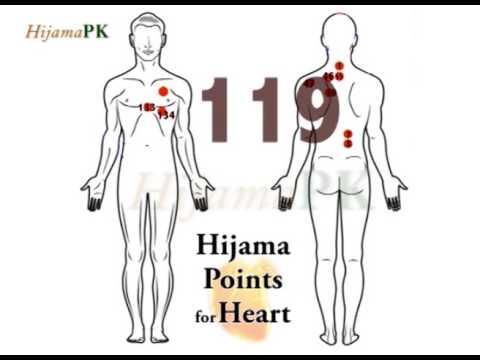 Hijama Sunnah Points Chart