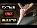 Diagnose and Manage Your Knee Pain: Bursitis