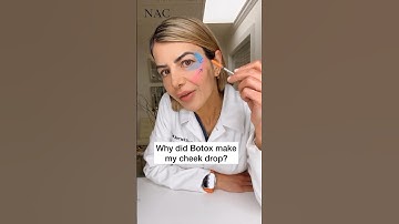Why did Botox make my cheek drop? #drbitafarrell #botox #botoxtreatment