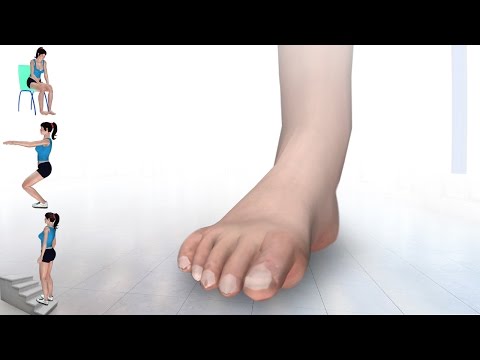 6 Exercises For High Ankle Sprain