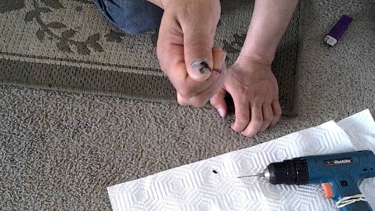 How To Fix A Smashed Nail YouTube