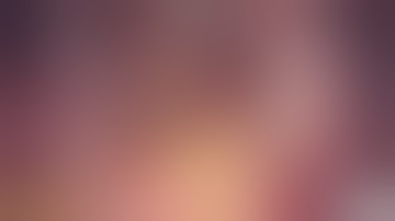 Identification of the right hypogastric nerve during surgery for deep infiltrating endometriosis