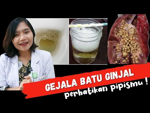 5 Gejala Batu Ginjal, Sering tidak Disadari  | dr. Emasuperr