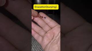 Acupressure point for gastric (Burping)#nepali #shortsvideo #acupressure