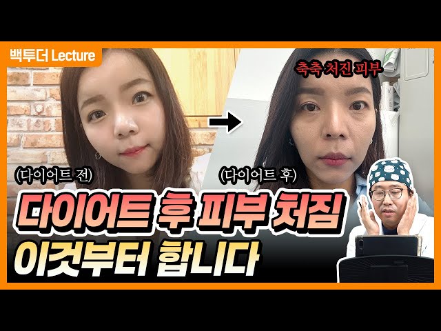 20kg 감량 후 망가진 얼굴, 백원장님을 만나고 어떻게 달라졌을까?