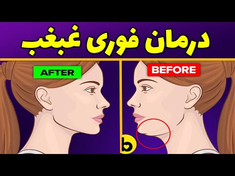 چگونه غبغب را ازبین ببریم درمان غبغب درخانه درمان فوری غبغب