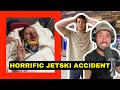 Nearly Fatal Jetski accident.. Hospital &amp; Surgery required.. (Jiggin &amp; Yappy) *BANGER PODCAST*