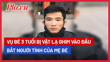 Bắt người tình của mẹ cháu bé 3 tuổi bị vật lạ ghim vào đầu - PLO