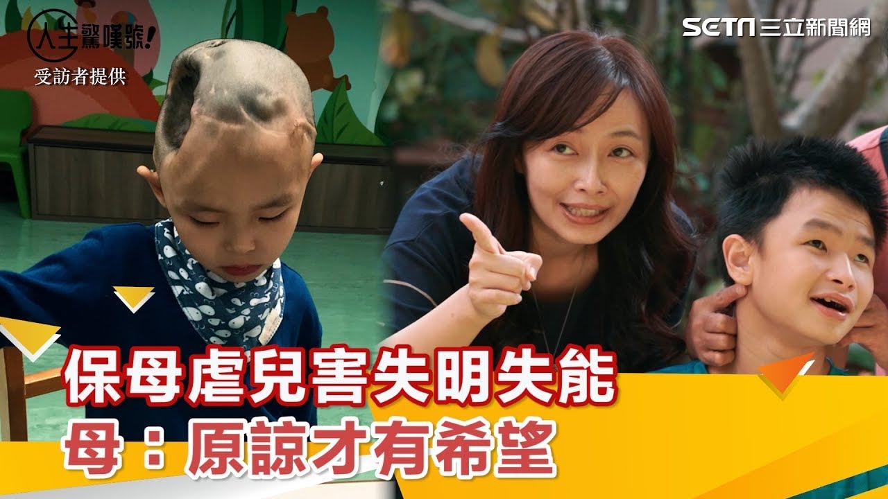 保母虐慘2歲兒！右腦切除害失明失能　母：我原諒保母　全家才有希望｜祝你健康