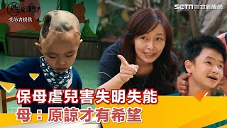 保母虐慘2歲兒！右腦切除害失明失能　母：我原諒保母　全家才有希望｜祝你健康