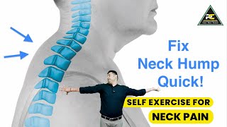 EASY HOME EXERCISE TO CORRECT NECK HUMP AND RELIEVE PAIN: TRY THIS NOW 