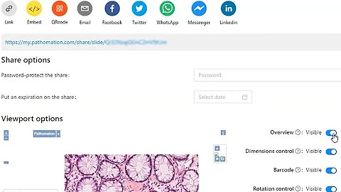 Share whole slide images, virtual microscopy, and digital pathology through My Pathomation