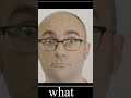 Vsauce is bald