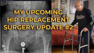 Update on my Upcoming Hip Replacement Surgery