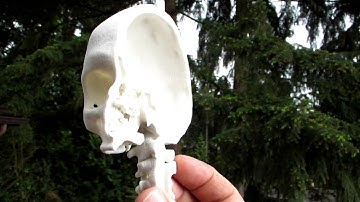 3D printed half-skull created from CT scan data