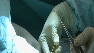 First Successful Birth in Transplanted Womb