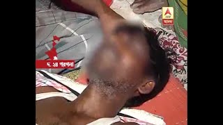 The person Ruthlessly Tortured in suspicion of thief at Joynagar