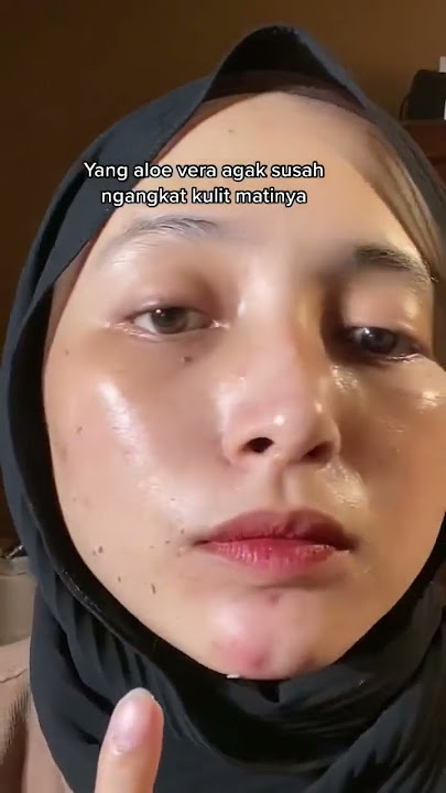 💛 Battle Peeling SYB: Charcoal vs Aloe Vera, mending yang mana ya?