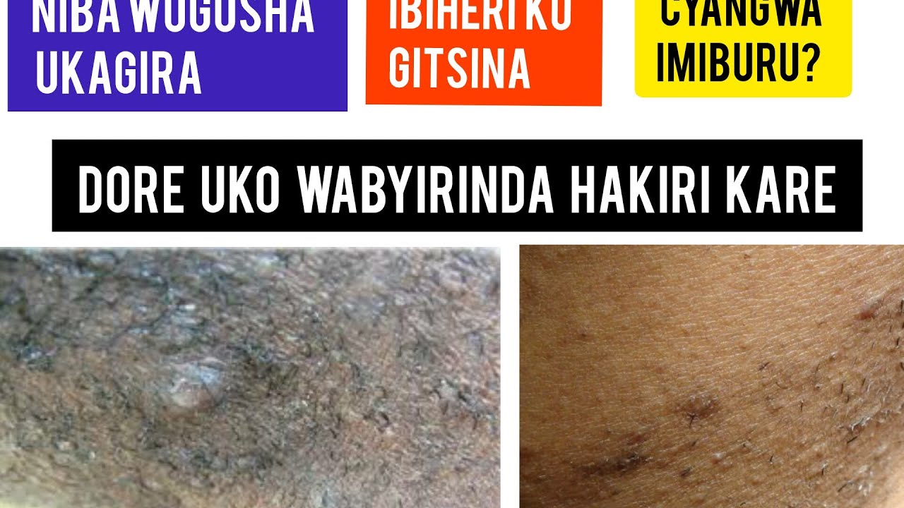 NTUZONGERA KUGIRA IMIBURU KUGITSINA NUBIGENZA UTYA 🇫🇷 /  UKO WAGAKWIYE  KOGOSHA KUMYANYA Y'IBANGA