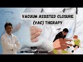 Vacuum assisted closure (VAC) Therapy