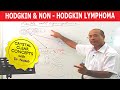 Hodgkin's vs Non-Hodgkin's Lymphoma - Pathology