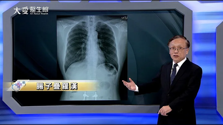 【大爱医生馆】肠子叠罗汉 20231227 - 天天要闻