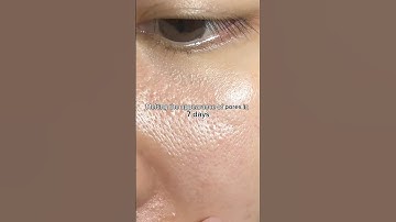 Pore minimizer? Finally💖 #skincare #koreanskincare #poreminimization #pore #skintips #enlargedpores