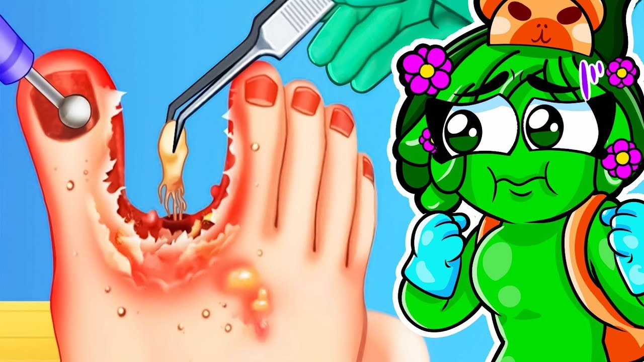 ME CONVERTI EN DOCTOR DE PIES EXTREMO 🤮🤢