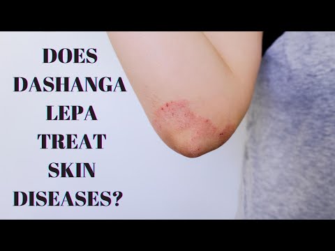 Dashanga Lepa - Benefits, How to use, Ingredients, Side effects