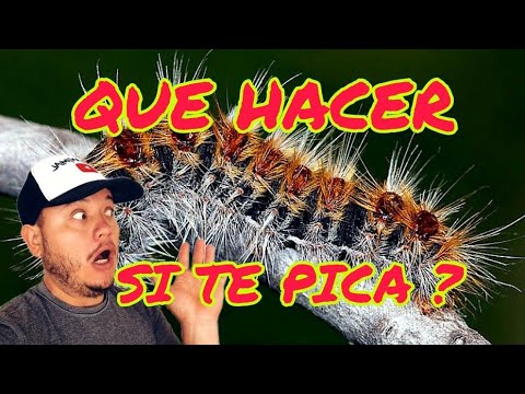 Video: ¿Te pueden picar los gusanos?