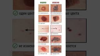 Не Трогайте Эти Образования На Коже, Можно Умереть