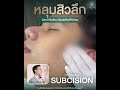 ✨โปรแกรม Subcision✨ เคลียร์หลุมสิวให้เรียบ