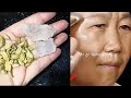 ضعيها علي التجاعيد ستختفي فورا‼️حتي لو عمرك 70 سنة ‼️يزيل التجاعيد فورا‼️تبدين أصغر سناً