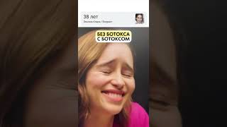 Мои мысли - в описании 👇🏻❤️ #ботокс #ботоксмосква #ботокстула #косметологтула