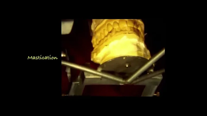 AO Webinar Rewind: Occlusion for Dental Implants, ...