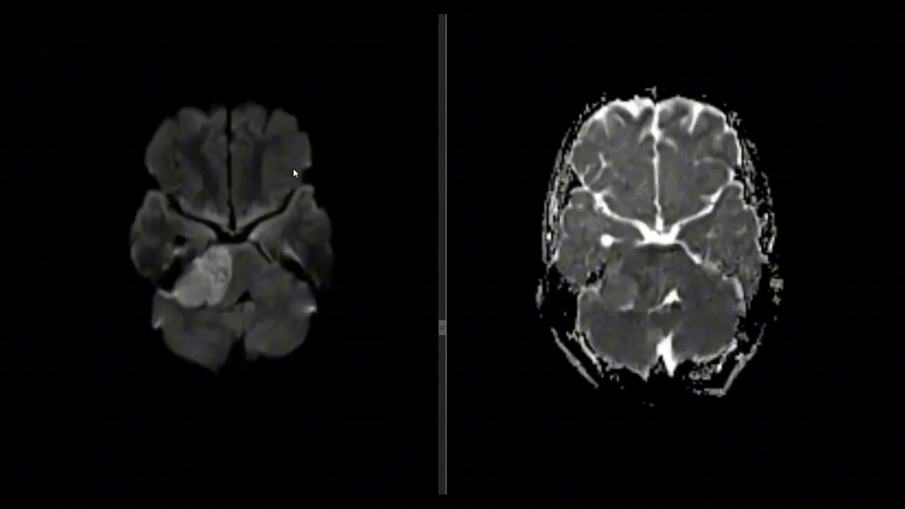 FRCR 2B VIVA SESSION 6