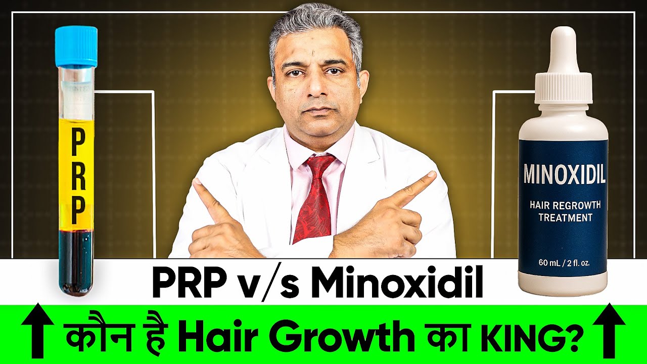 Minoxidil vs PRP - Which One is Best for Hair Loss | Hair Growth Treatment and Tips