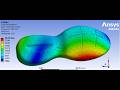 Cad Design & Finite Element Ergonomic analysis of foot-shoe and shoe-ground in Ansys Solidworks