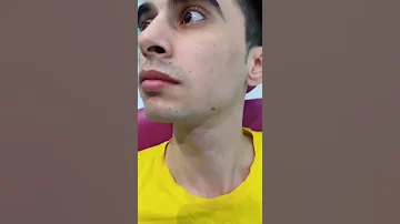 أسهل طريقة زاله شامه الوجه 