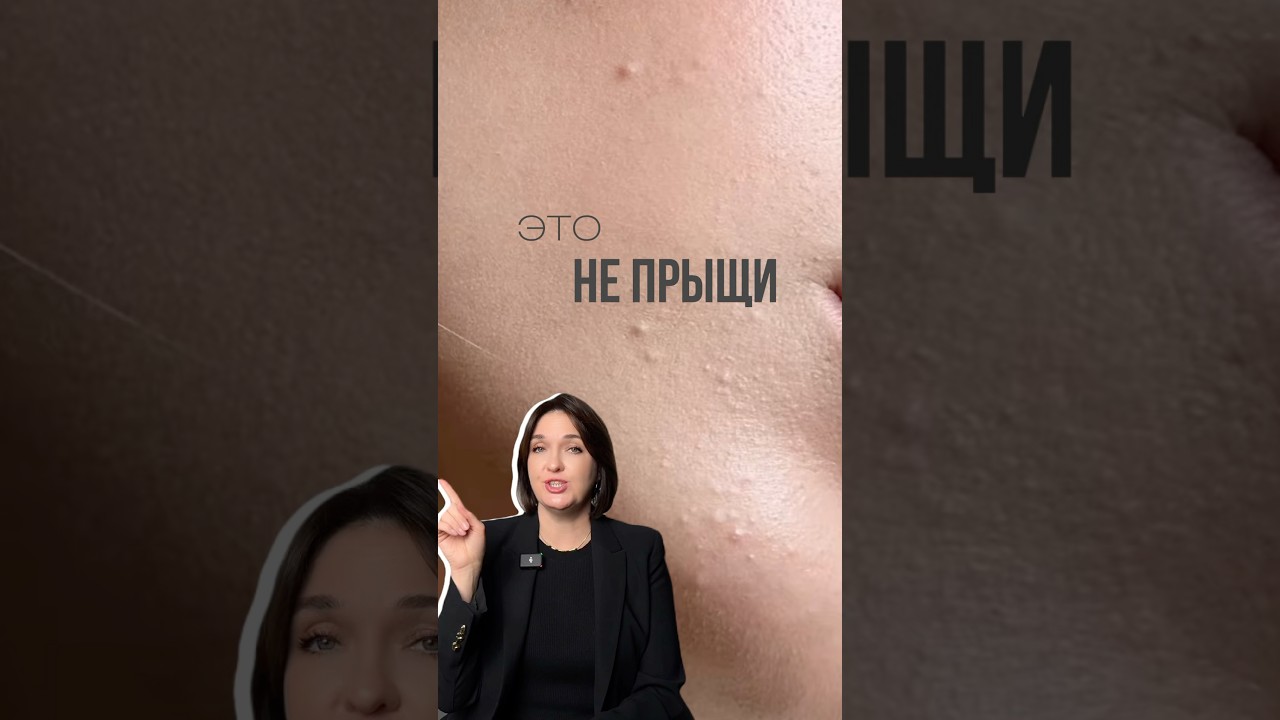 Как убрать милиумы #уходзакожей #акне #косметолог #уходзажирнойкожей