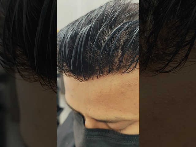 9899746489 Thinnest hair patch in Delhi India #reels #viral #explore #natural #delhi #india #result