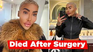 Famous Jordan James Parke Dies After Cosmetic Procedure Profile