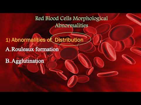 Abnormalities of RBCs كرات الدم الحمراء وتفسير أشكالها المختلفه