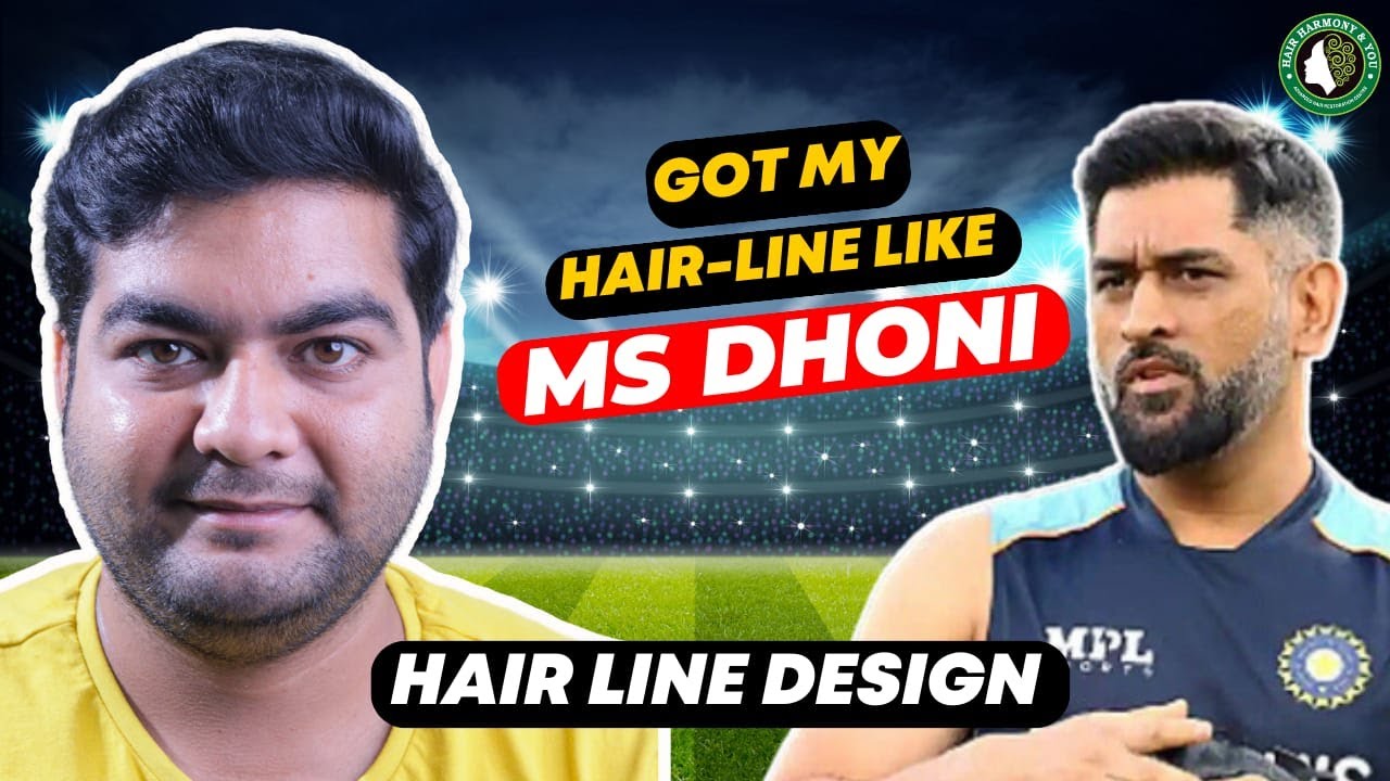 Best Hair Transplant in Bhubaneswar Best Hair Transplant Result