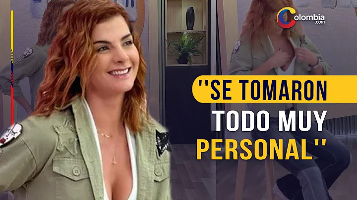 Carolina Cruz habl de su comentario de las prtesis