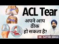 क्या ACL Tear अपने आप ठीक हो सकता है? Can ACL Heal on its Own? ACL Tear Causes, Treatment in Hindi